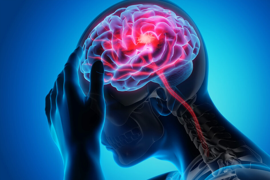 6 étapes pour prévenir les accidents vasculaires cérébraux