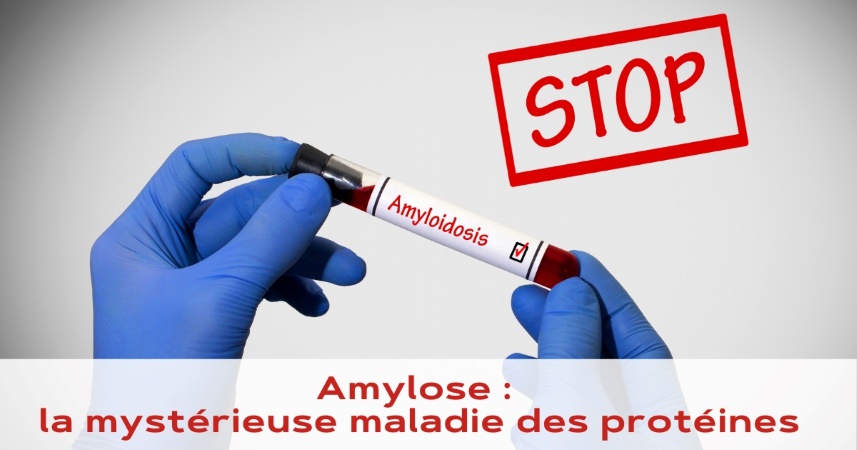 Amylose : la mystérieuse maladie des protéines