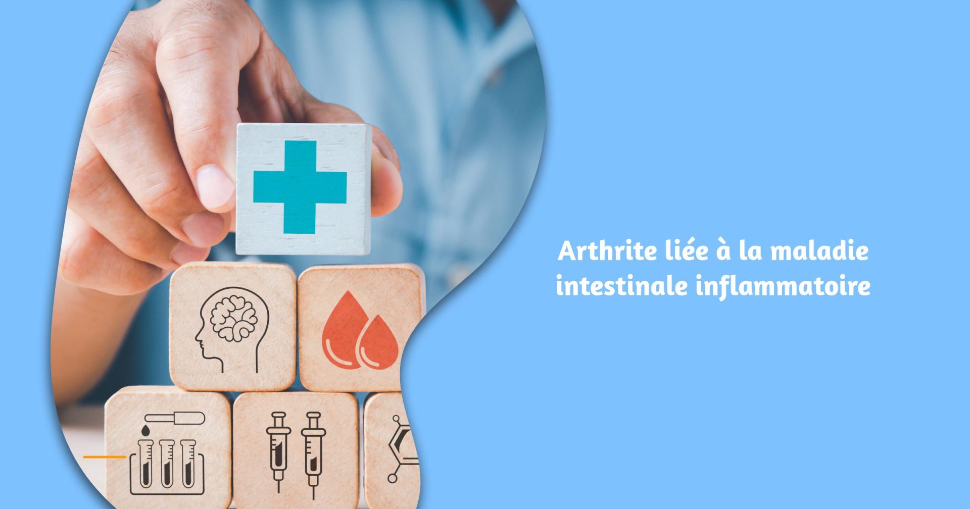 Arthrite liée à la maladie intestinale inflammatoire