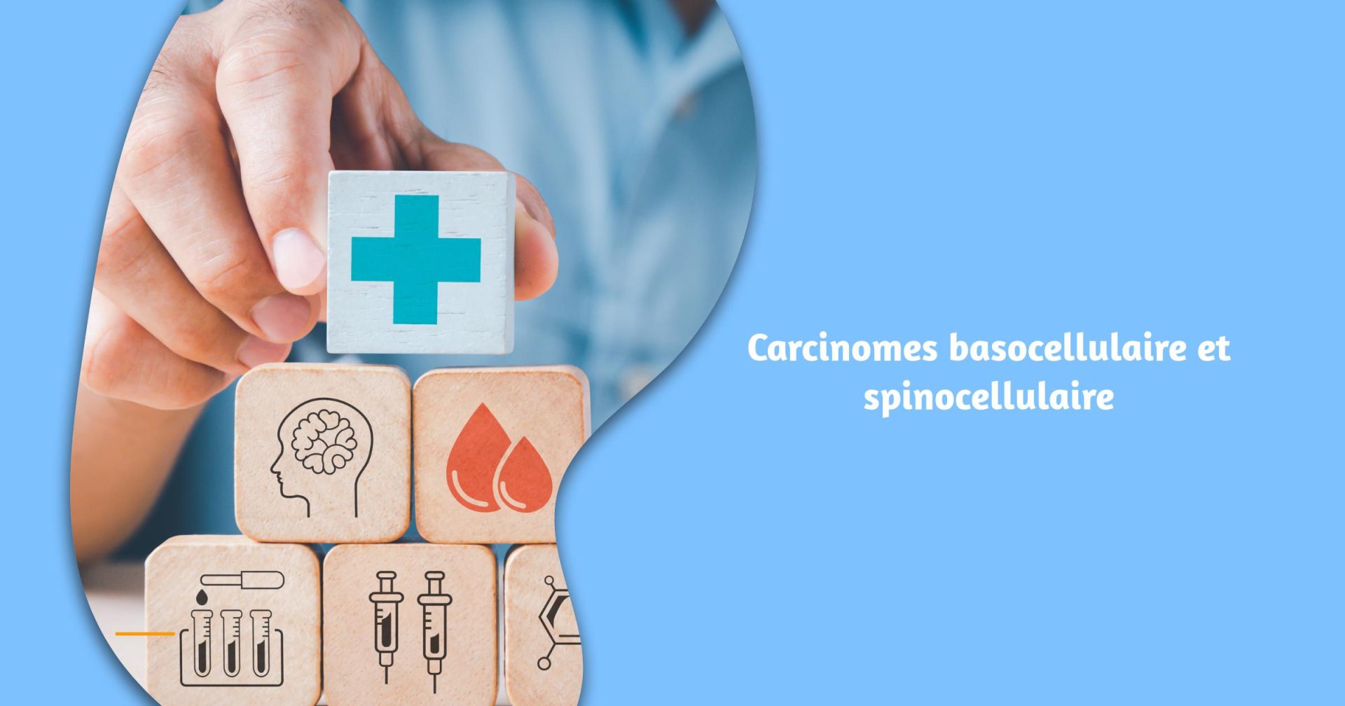 Carcinomes basocellulaire et spinocellulaire