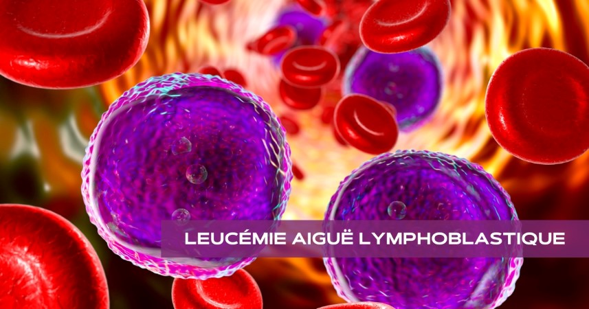 Leucémie aiguë lymphoblastique
