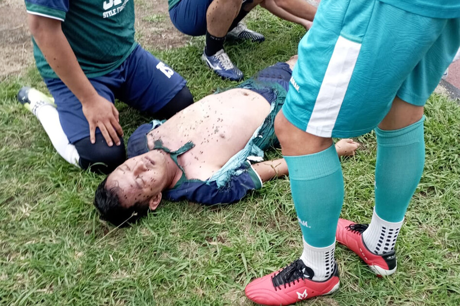 Décès d'un joueur indonésien frappé par la foudre sur le terrain