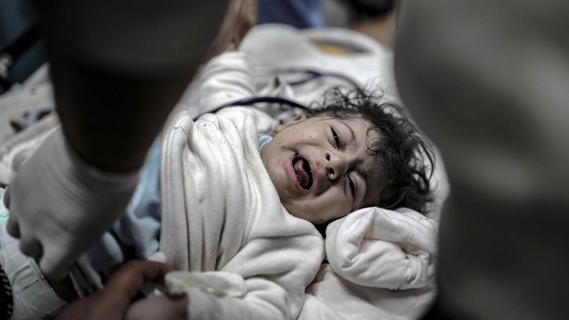 Médecin: des enfants du nord de Gaza meurent de malnutrition