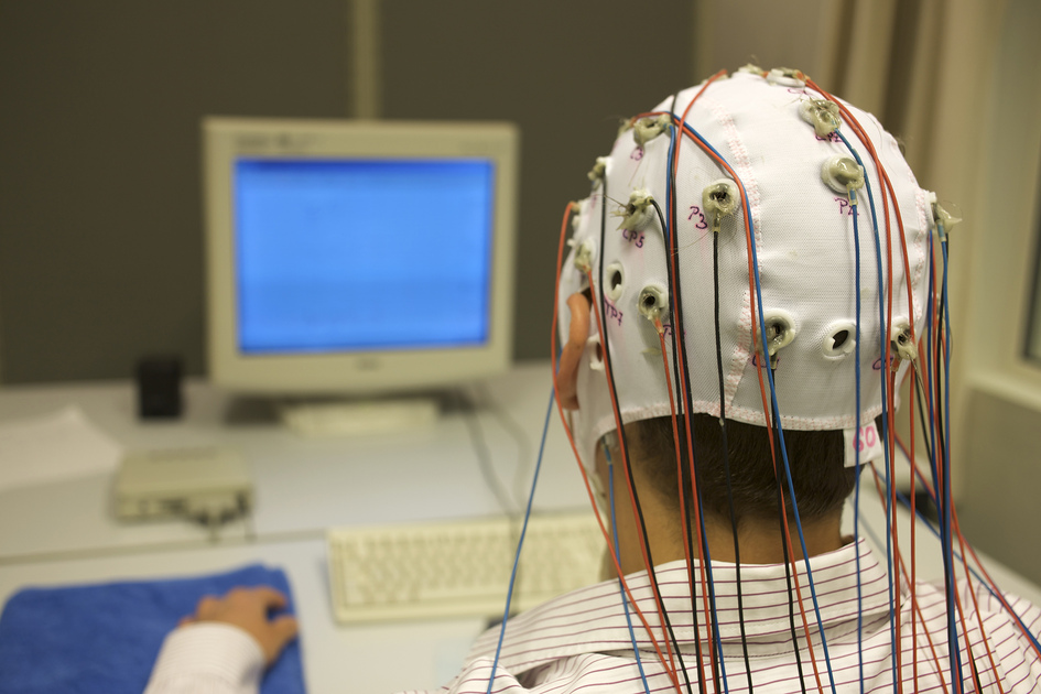 Nouveau type d'électrodes pour surveiller le cerveau des épileptiques