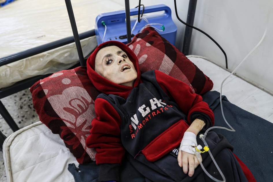 Famine à Gaza, 16 enfants décédés, d'autres en danger