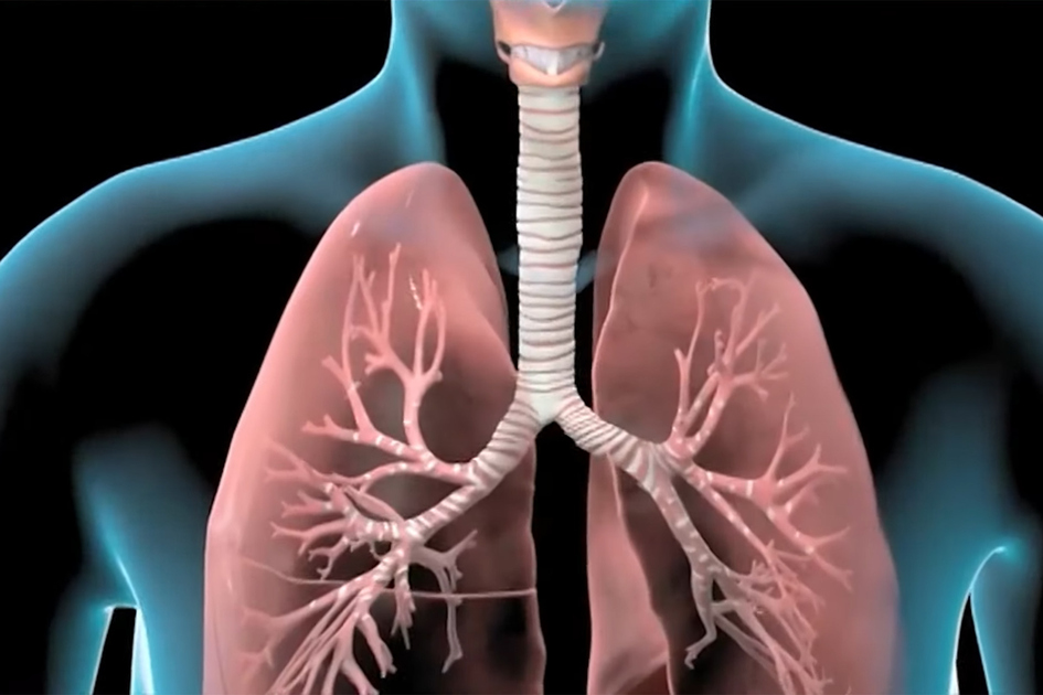 Bronchite aiguë: symptômes et risques à connaître