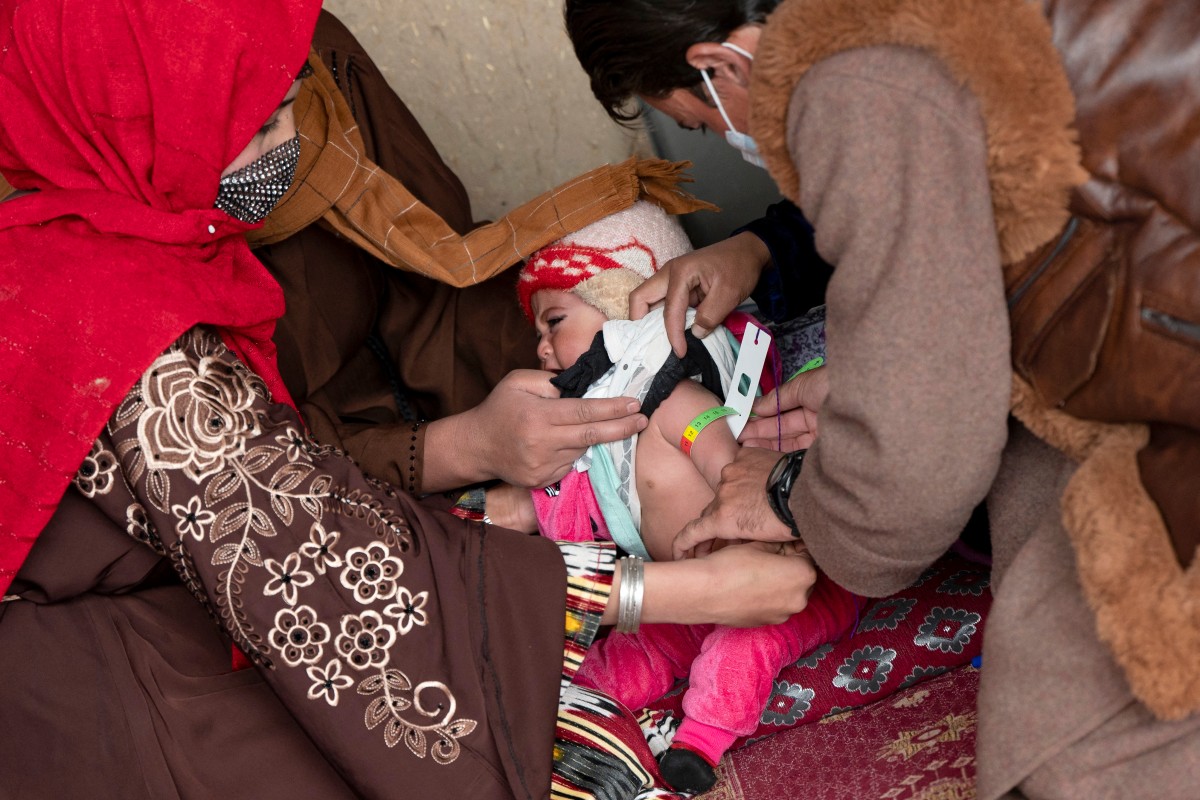 Malnutrition en Afghanistan, 1 enfant sur 10 touché, 45% atteints de retard de croissance selon l'ONU