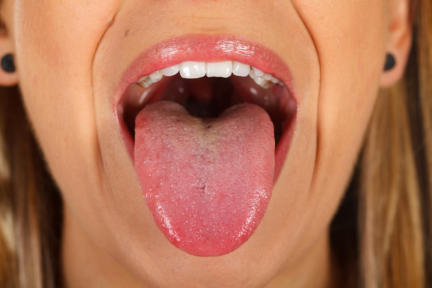 Attention à la tache blanche sur la langue risque de cancer expliqué en vidéo.jpeg