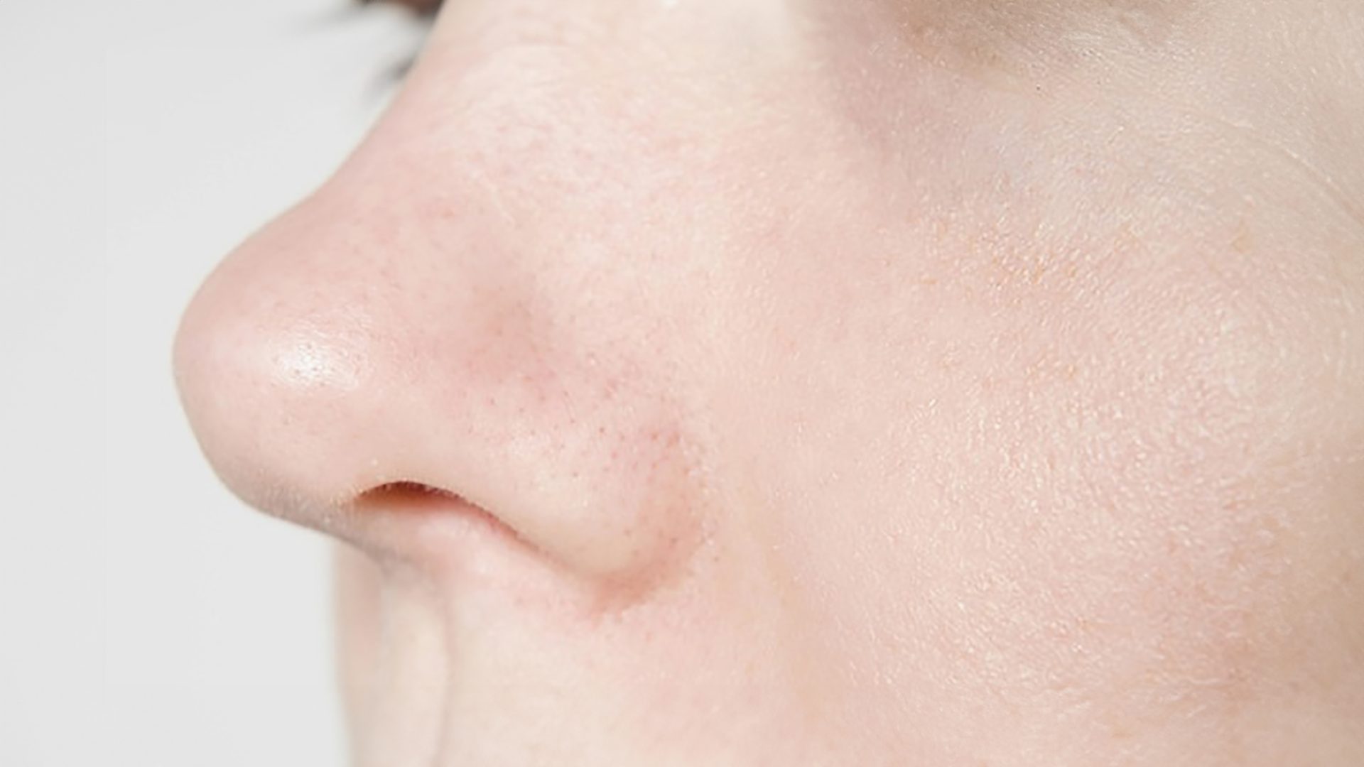 Comment reconnaître et traiter une fracture du nez