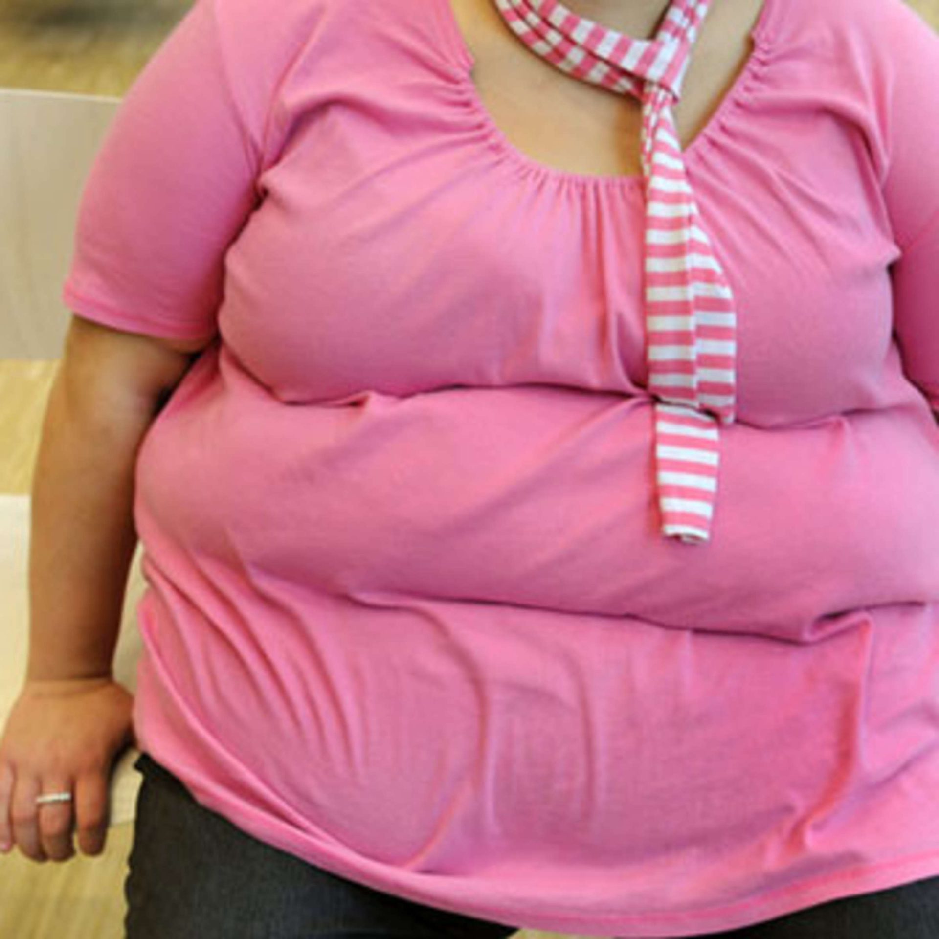La chirurgie de perte de poids réduit le risque d'apnée mortelle